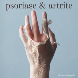 PESSOAS COM PSORIASE E ARTRITE