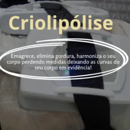 *Promoção de criolipólise*