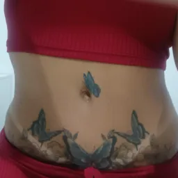 Plástica das divas😍