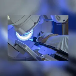 CURSO DE ESPECIALIZAÇÃO EM RADIOTERAPIA